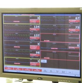 中央監測螢幕-可監測所有開刀中麻醉之病人心電圖、血壓、血氧等生命現象